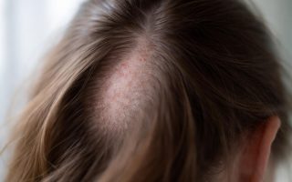 cuir-chevelu-texture-lumiere-naturelle