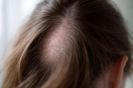 cuir-chevelu-texture-lumiere-naturelle